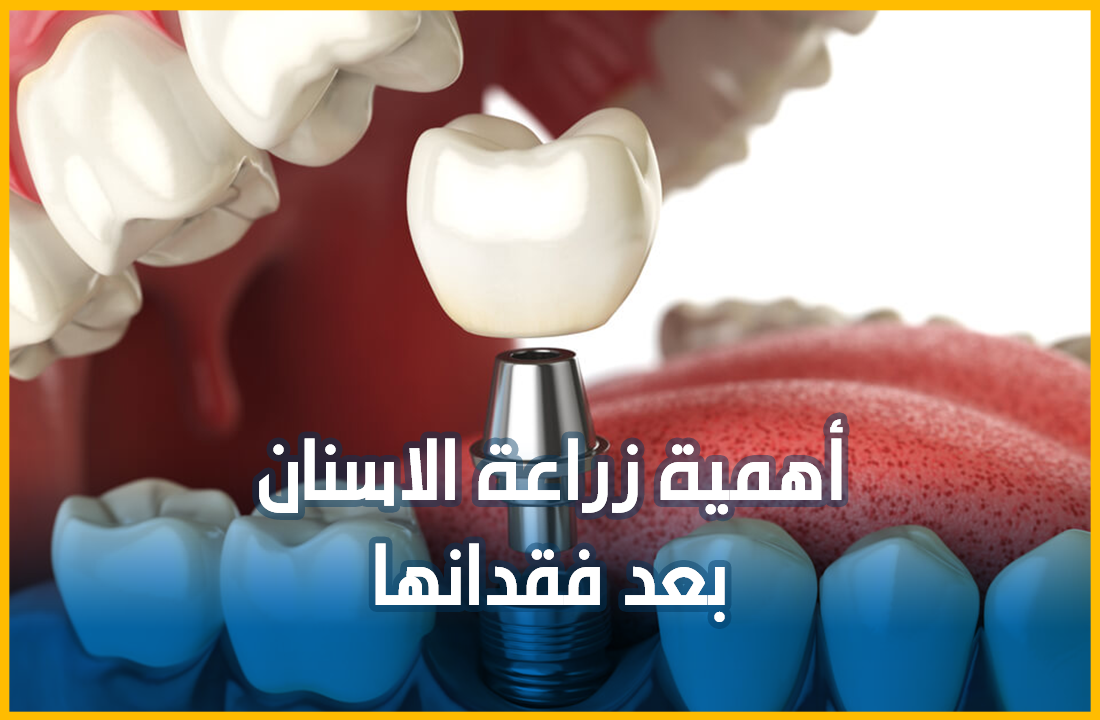 زراعة.png