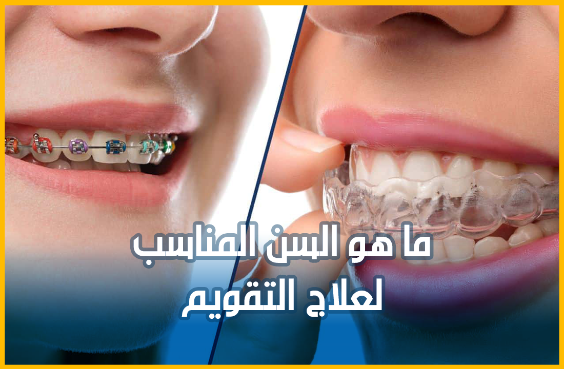 علاج-التقويم.png