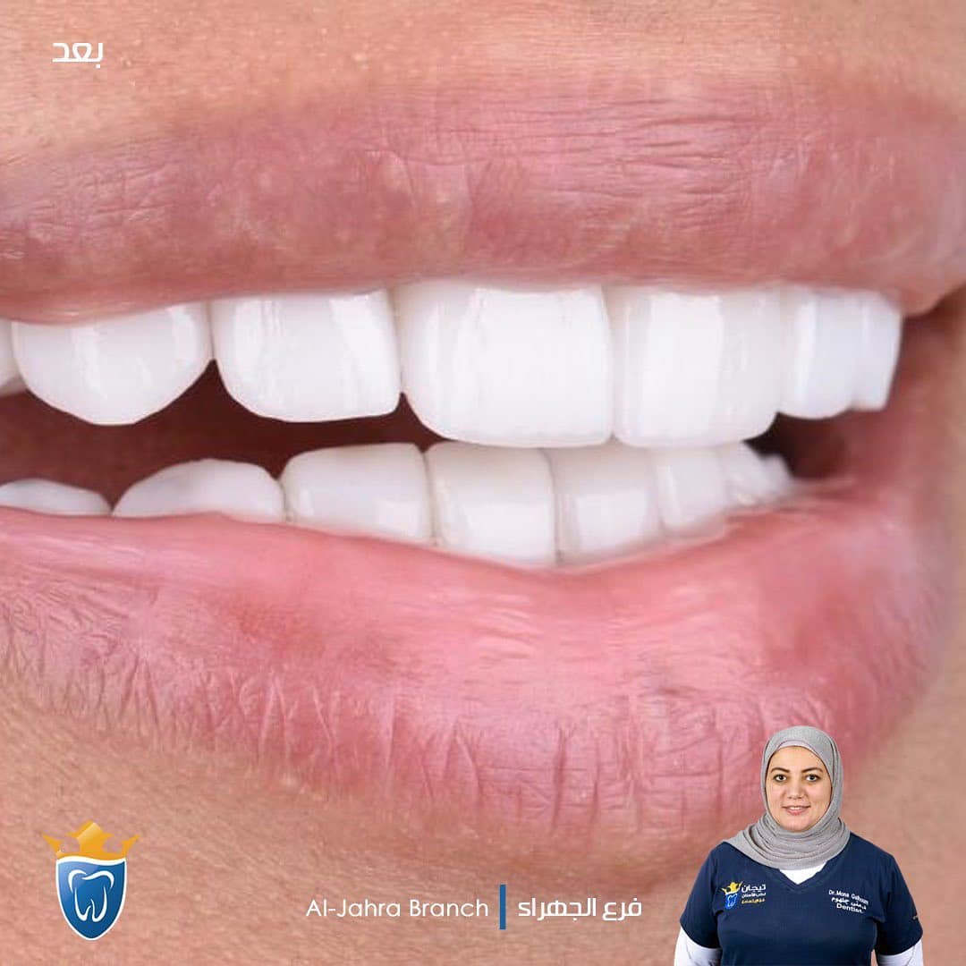 افضل عيادة اسنان في الكويت