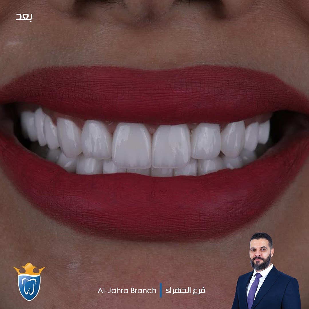  افضل عيادة اسنان في الكويت