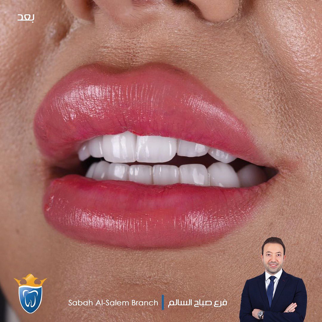  افضل عيادة اسنان في الكويت