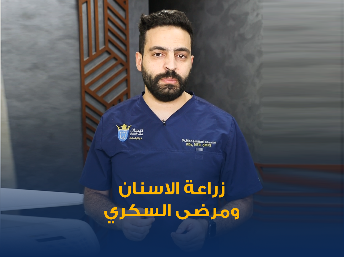 زراعة-الاسنان-ومرضى-السكرى.png