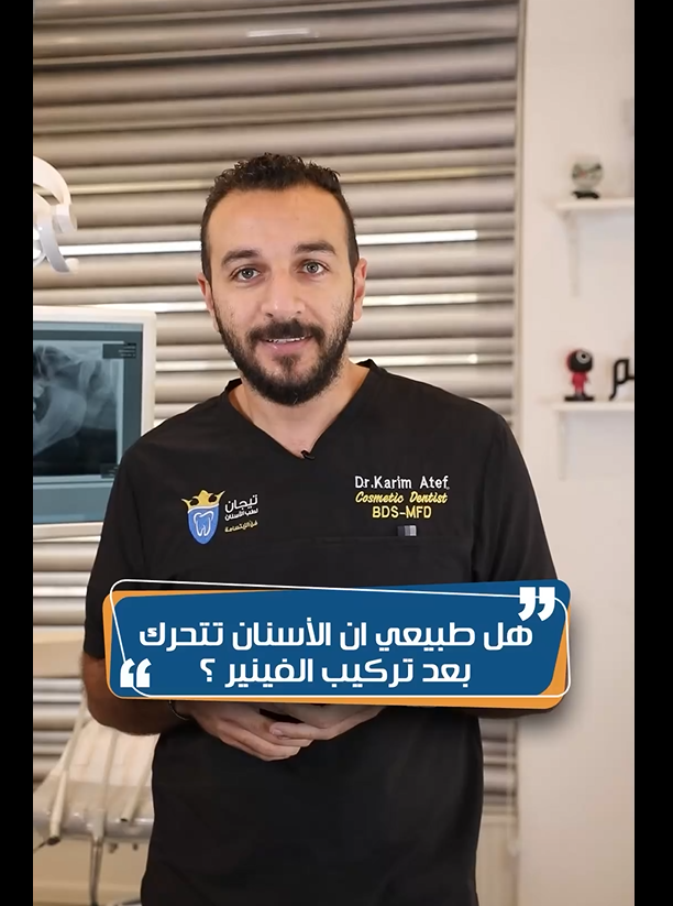 كيفية-الحفاظ-على-التركيبات.png