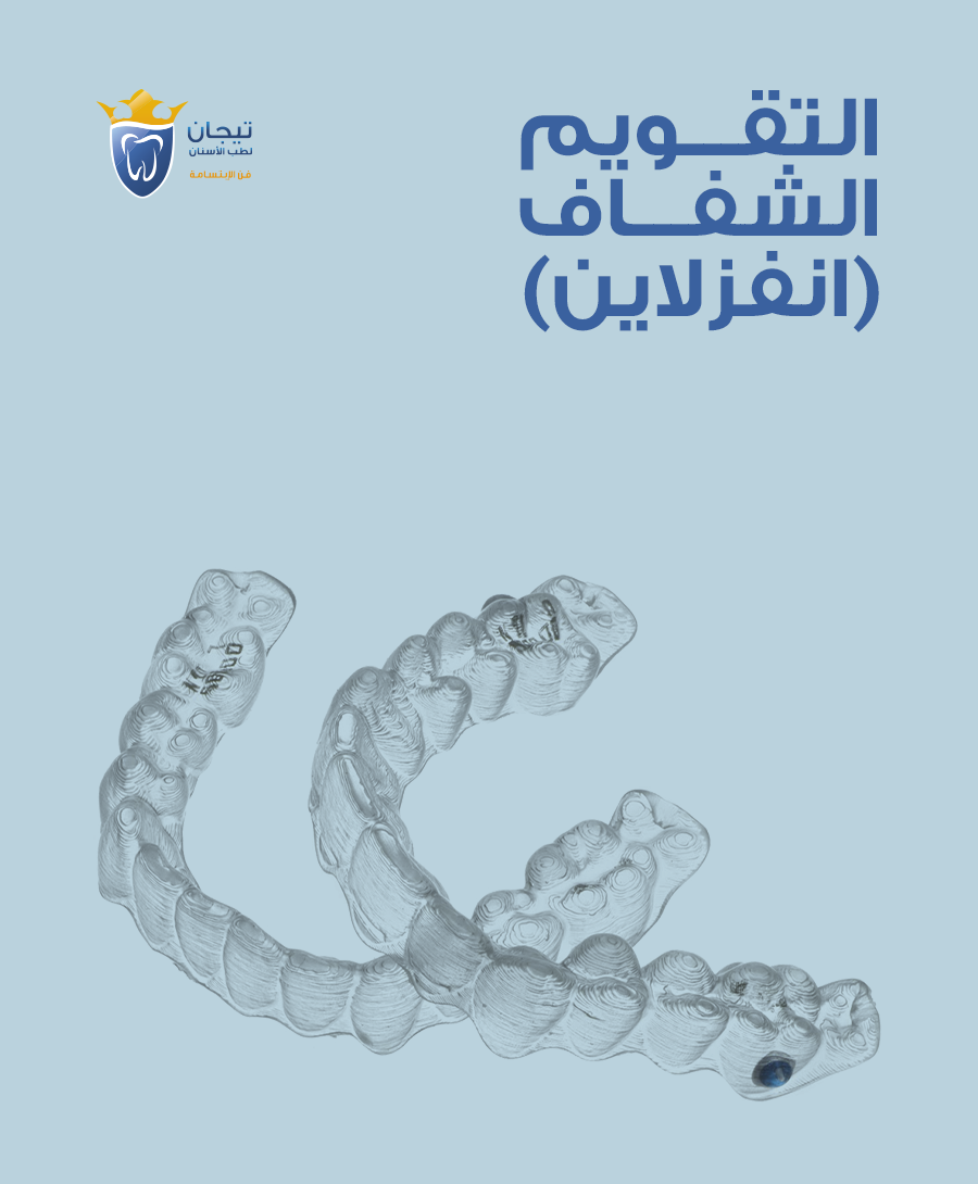 التقويم الشفاف