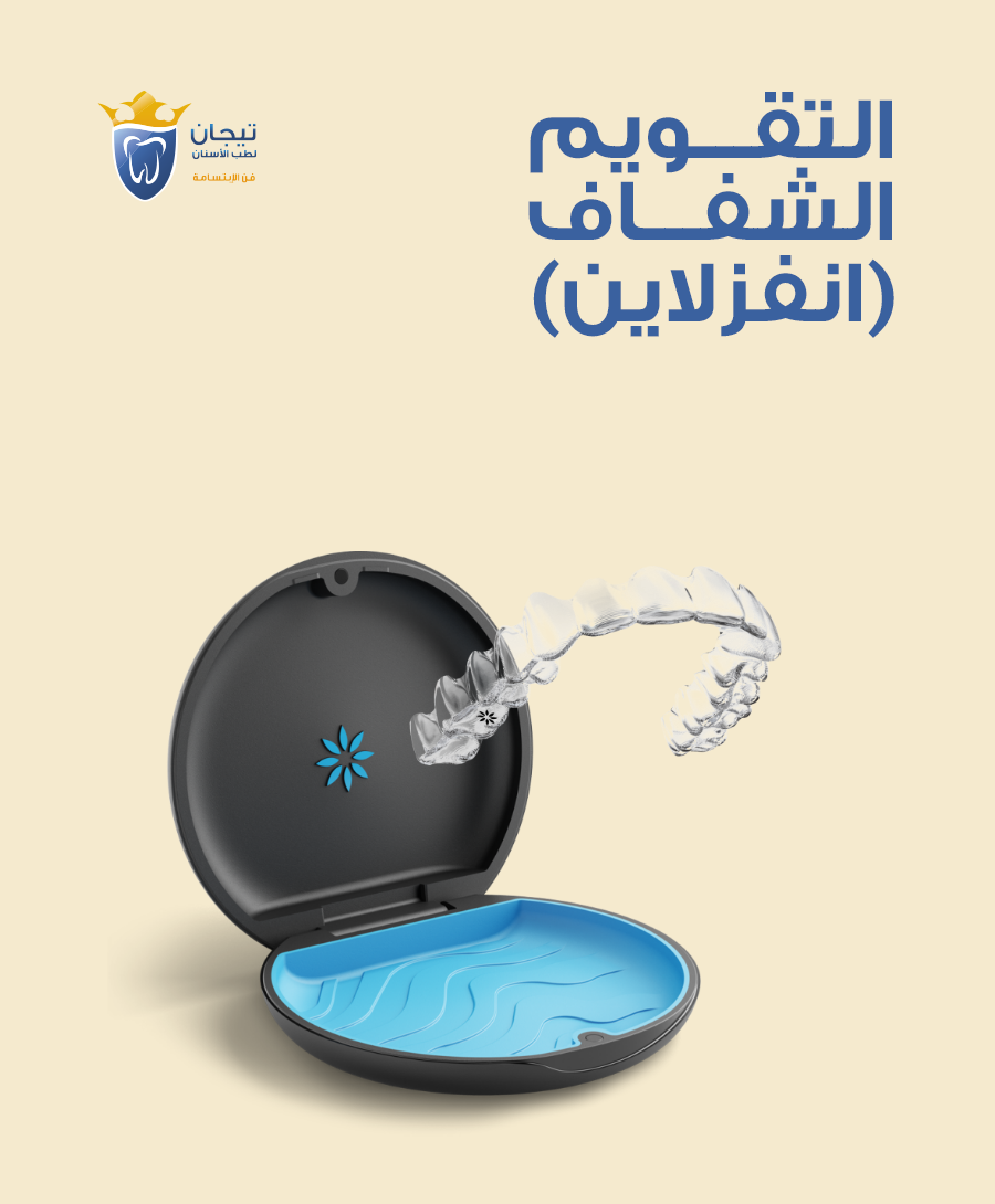 التقويم الشفاف
