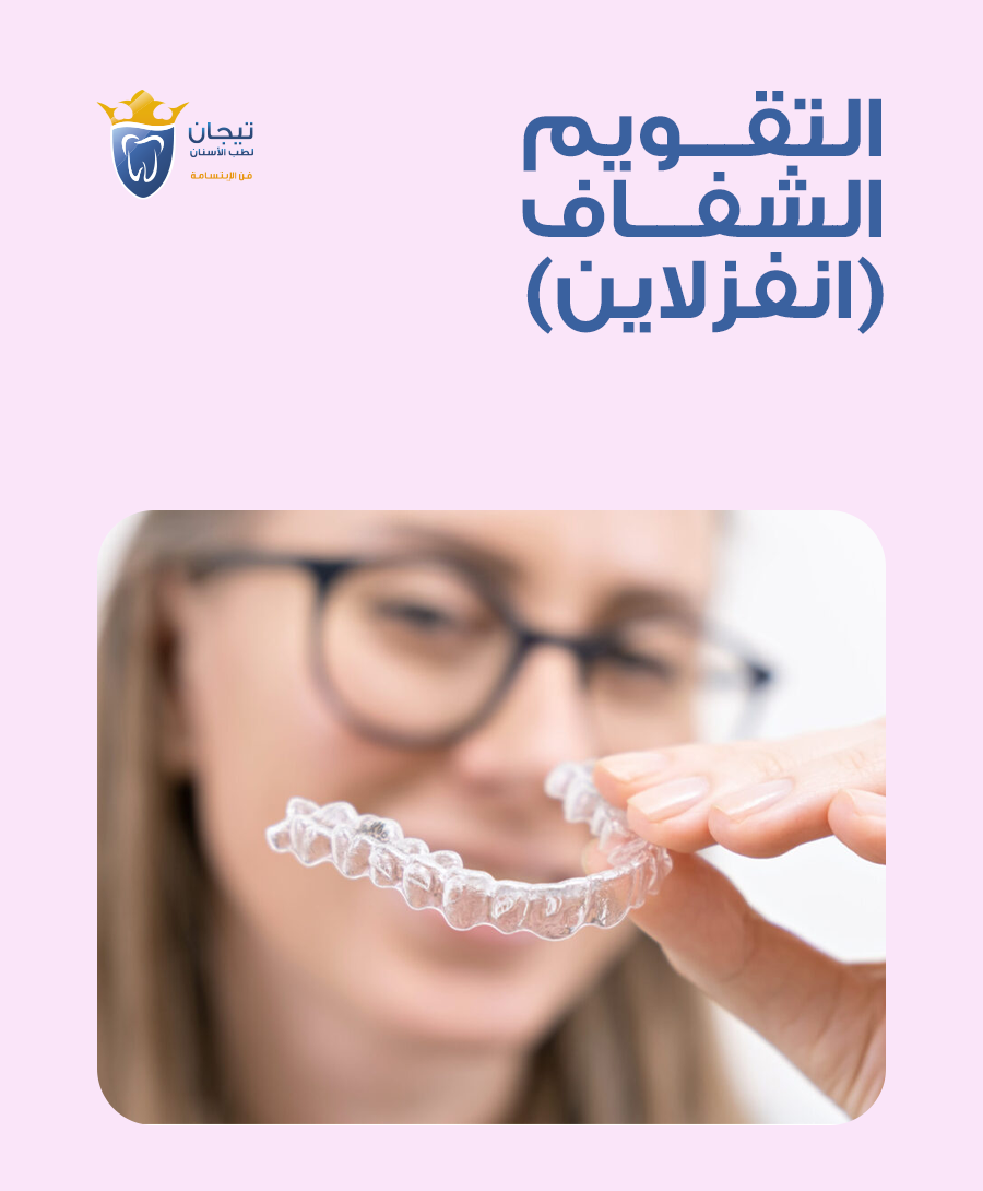 التقويم الشفاف