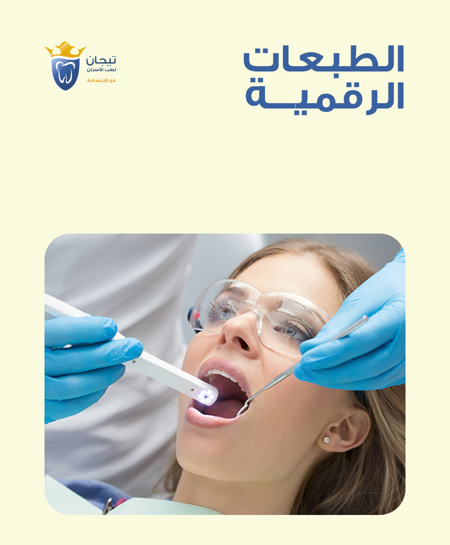 الطبعة الرقمية للاسنان