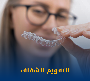 التقويم الشفاف
