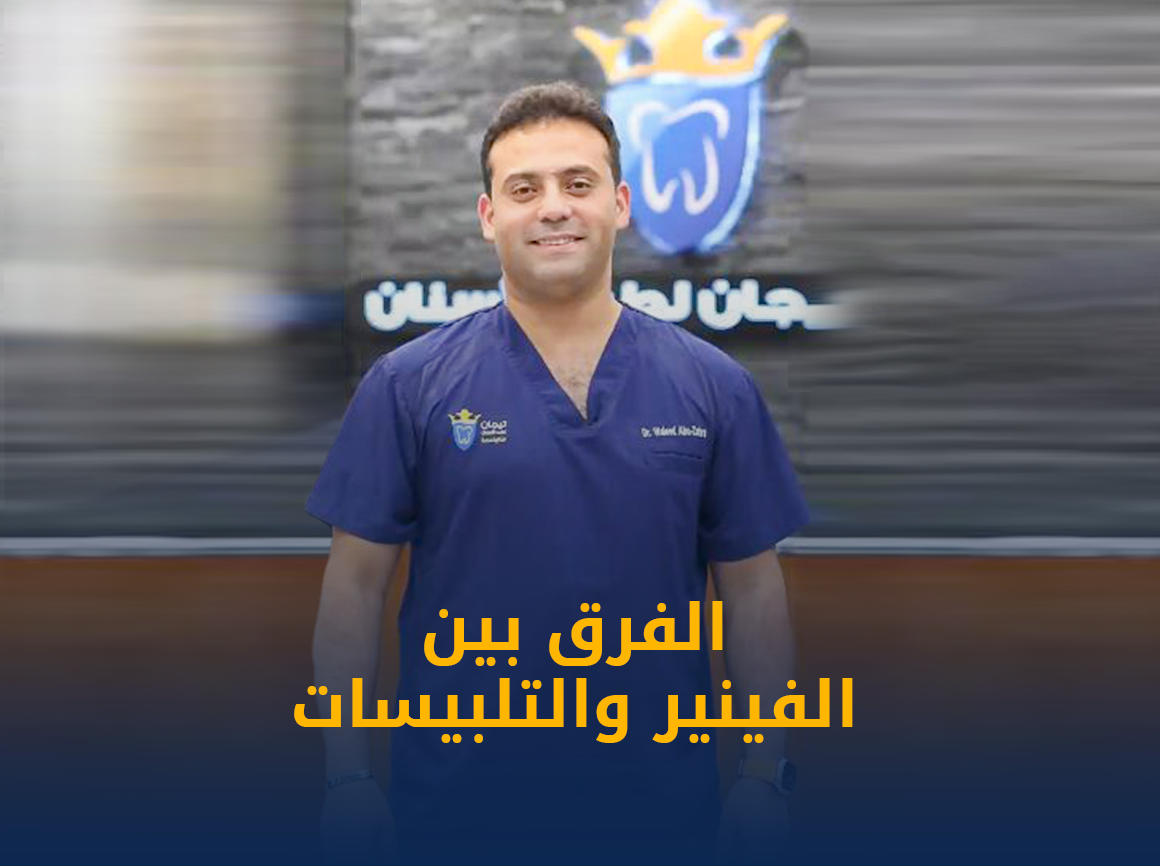 الفينير.png