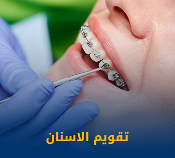 تقويم الاسنان