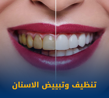 تنظيف وتبييض الاسنان
