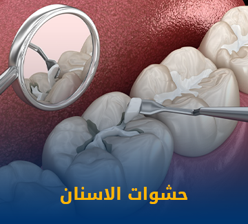حشوات الاسنان