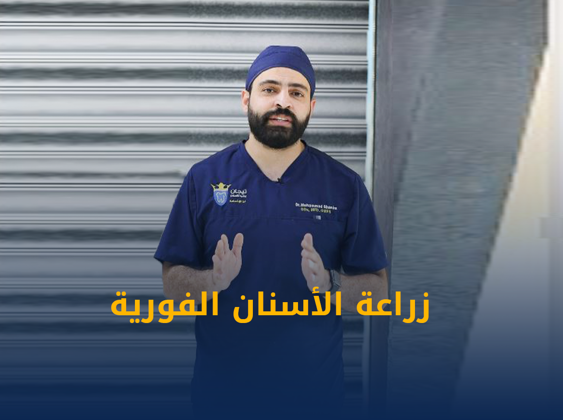 زراعة-الاسنان-الفورية.png