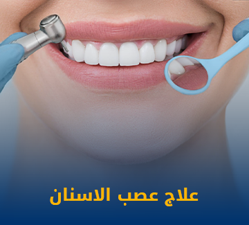 علاج عصب الاسنان