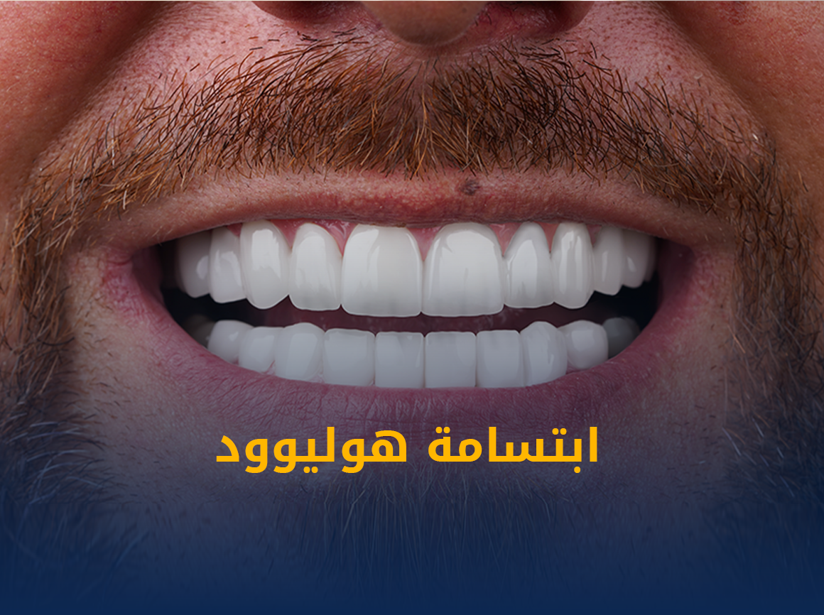 ابتسامة-هوليوود.png