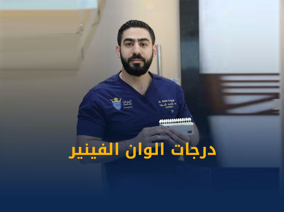 الوان-فينير-الاسنان-2.jpg