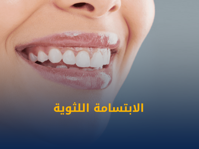تجميل الاسنان,زراعة اسنان,تقويم اسنان,تنظيف اسنان,تبييض اسنان