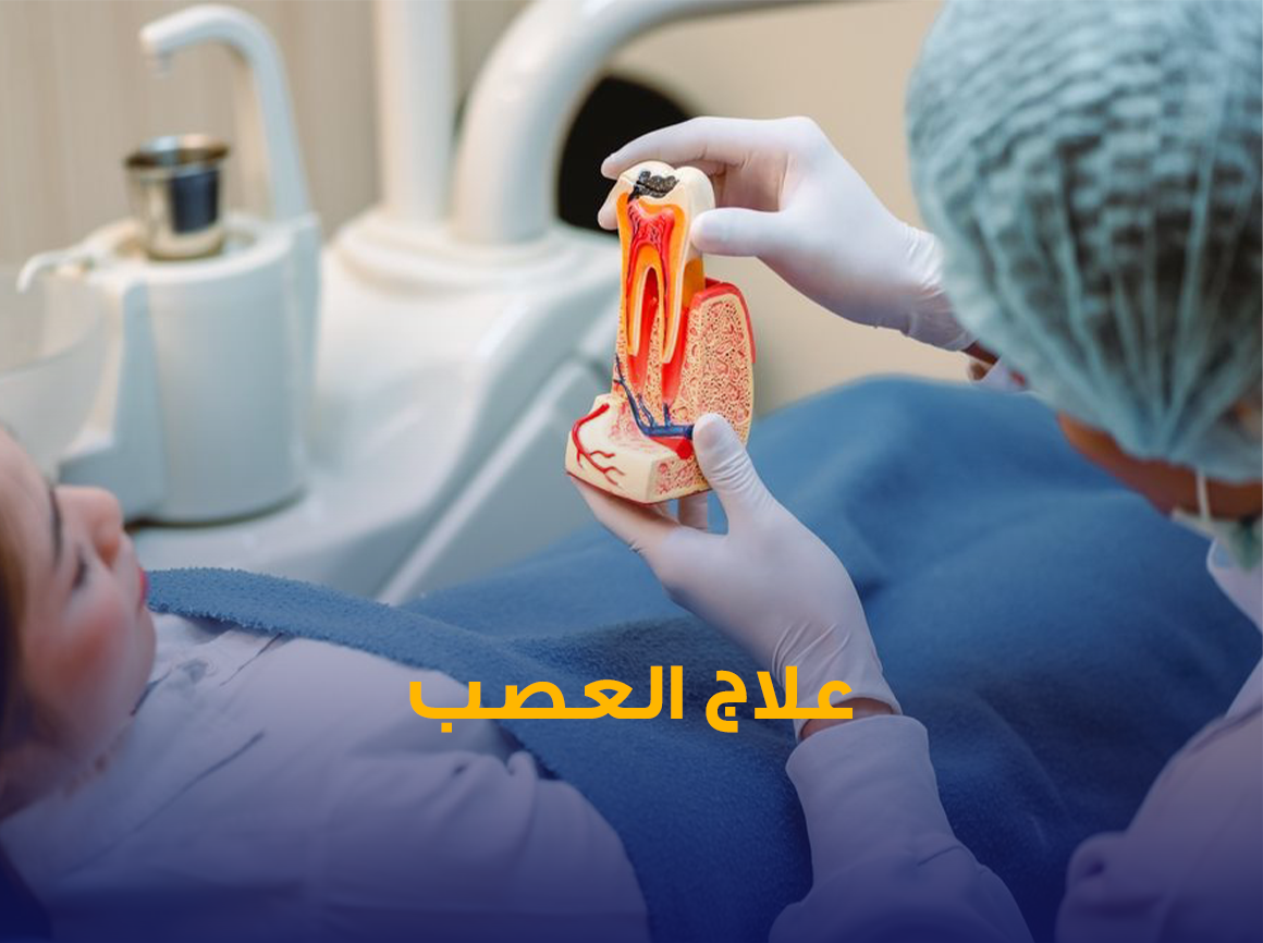 علاج-العصب.png