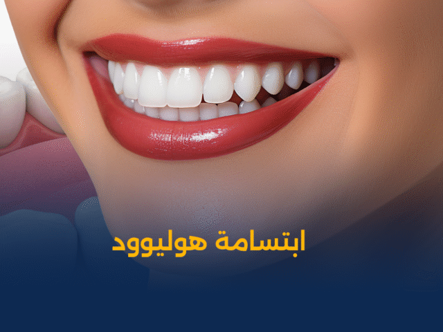 تجميل الاسنان,زراعة اسنان,تقويم اسنان,تنظيف اسنان,تبييض اسنان