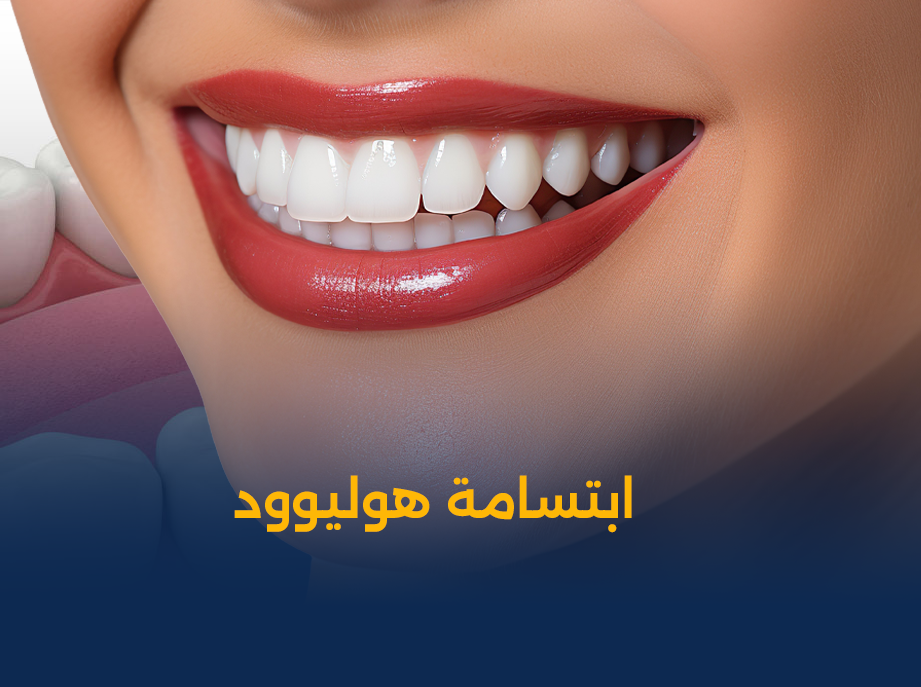 ابتسامة-هوليوود-في-الكويت.png