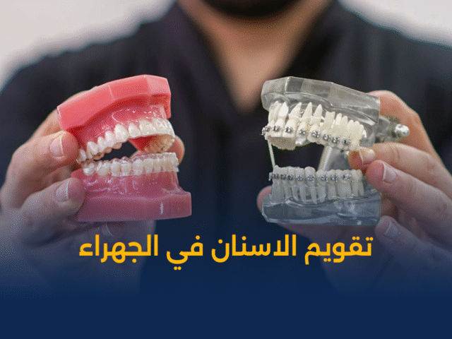 التقويم الشفاف,جهاز الاي تيرو iTero,الطبعة الرقمية للاسنان,تقويم انفزلاين الكويت,تقويم شفاف