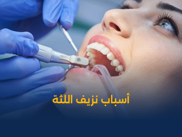 تجميل الاسنان,زراعة اسنان,تقويم اسنان,تنظيف اسنان,تبييض اسنان