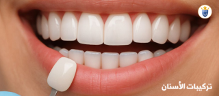 تركيبات الاسنان